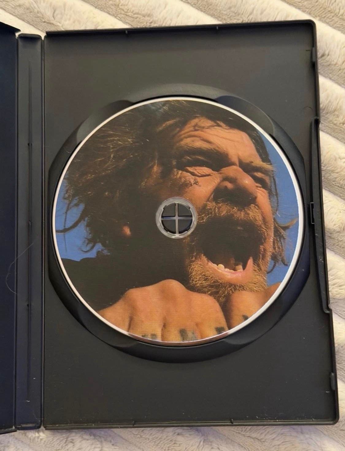 Bumfights Cause For Concern Volume 1 DVD 2