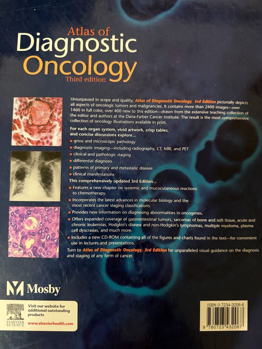 Mosby Atlas of Diagnostic Oncology Third Edition Arthur T Skarin 3